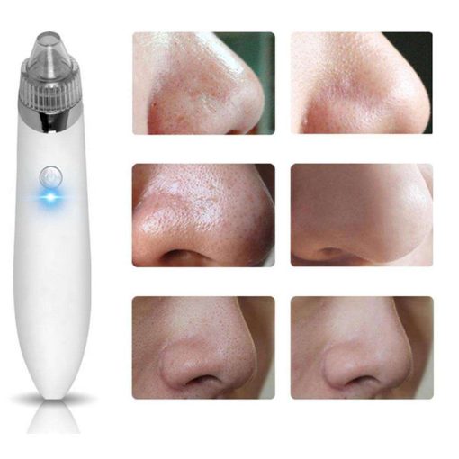 Comedone Vacuum Pro exfoliate pores wrinkle dry acne